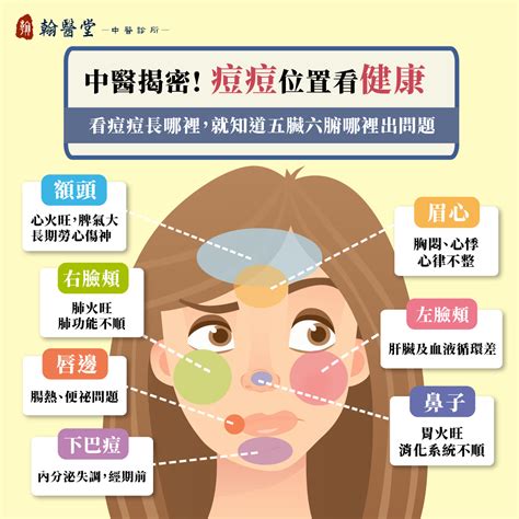 痘痘長得位置|青春痘、下巴痘痘長這個位置代表什麼意思？先弄懂長。